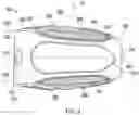 Fig. 04 - Dynamic intervertebral spacer implant