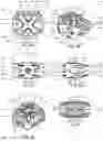 Fig. 09 - Dynamic intervertebral spacer implant