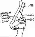 Fig. 01 - Systems and methods for nasal support