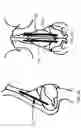 Fig. 03 - Systems and methods for nasal support