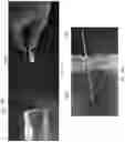 Fig. 13 - Systems and methods for nasal support