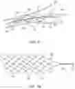 Fig. 07 - Medical device for sensing and or stimulating tissue