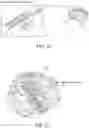 Fig. 25 - Medical device for sensing and or stimulating tissue
