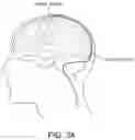Fig. 26 - Medical device for sensing and or stimulating tissue