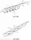 Fig. 30 - Medical device for sensing and or stimulating tissue