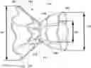 Fig. 01 - Systems and methods for making encapsulated hourglass shaped stents