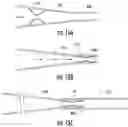 Fig. 10 - Systems and methods for making encapsulated hourglass shaped stents