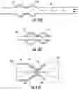 Fig. 11 - Systems and methods for making encapsulated hourglass shaped stents