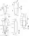 Fig. 02 - Balloon catheters and methods for use
