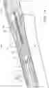 Fig. 04 - Handle for medical device deployment