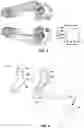 Fig. 03 - Use of additive manufacturing processes in the manufacture of custom orthoses
