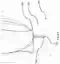 Fig. 09 - Menstrual Cup