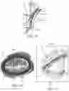 Fig. 02 - Forceps treatment systems