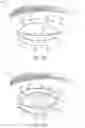 Fig. 03 - Forceps treatment systems