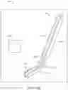 Fig. 11 - Forceps treatment systems