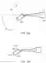 Fig. 15 - Forceps treatment systems