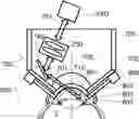 Fig. 01 - Surgical system and procedure for precise intraocular pressure reduction
