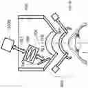 Fig. 11 - Surgical system and procedure for precise intraocular pressure reduction