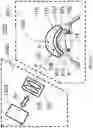 Fig. 13 - Surgical system and procedure for precise intraocular pressure reduction