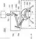 Fig. 14 - Surgical system and procedure for precise intraocular pressure reduction