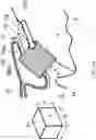 Fig. 16 - Surgical system and procedure for precise intraocular pressure reduction