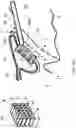 Fig. 24 - Surgical system and procedure for precise intraocular pressure reduction