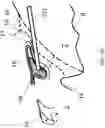 Fig. 27 - Surgical system and procedure for precise intraocular pressure reduction