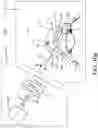 Fig. 13 - Surgical system and procedure for treatment of the trabecular meshwork and Schlemm's canal using a femtosecond laser