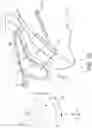 Fig. 17 - Surgical system and procedure for treatment of the trabecular meshwork and Schlemm's canal using a femtosecond laser