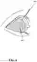 Fig. 07 - Ocular shield for facilitating generation of visual evoked potentials (VEP)