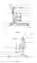 Fig. 05 - Flexible leg supporting membrane, leg support frame and mobile patient standing and raising aid