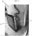 Fig. 12 - Temperature-Controlled Cradle