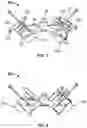 Fig. 06 - Apparatus for treating lower limb contractures