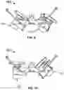 Fig. 07 - Apparatus for treating lower limb contractures
