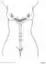 Fig. 02 - Sex toy