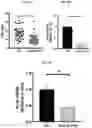 Fig. 14 - Methods and compositions targeting lung microbiota and its responding immune pathways for lung cancer treatment