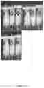 Fig. 11 - Lipid formulations for delivery of messenger RNA