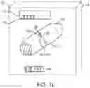 Fig. 04 - Therapeutic preparation comprising insulin for delivery into a lumen of the intestinal tract using a swallowable drug delivery device