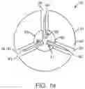 Fig. 11 - Therapeutic preparation comprising insulin for delivery into a lumen of the intestinal tract using a swallowable drug delivery device