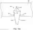 Fig. 35 - Therapeutic preparation comprising insulin for delivery into a lumen of the intestinal tract using a swallowable drug delivery device