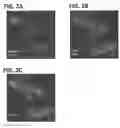 Fig. 03 - Polynucleotides encoding methylmalonyl-CoA mutase