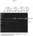 Fig. 06 - Polynucleotides encoding methylmalonyl-CoA mutase