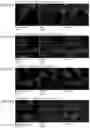 Fig. 07 - Polynucleotides encoding methylmalonyl-CoA mutase