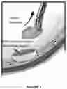 Fig. 03 - Intraoperative topically-applied non-implantable rapid release patch
