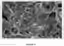 Fig. 09 - Intraoperative topically-applied non-implantable rapid release patch
