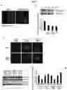 Fig. 07 - Pharmaceutical composition, containing NM23 activator, for inhibiting cancer metastasis