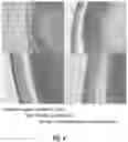 Fig. 05 - COMPOSITIONS AND METHODS TO REDUCE PATHOGENESIS