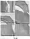 Fig. 07 - COMPOSITIONS AND METHODS TO REDUCE PATHOGENESIS