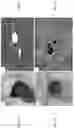Fig. 02 - POLYHYDROXYLATED BILE ACIDS FOR TREATMENT OF BILIARY DISORDERS