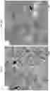 Fig. 05 - POLYHYDROXYLATED BILE ACIDS FOR TREATMENT OF BILIARY DISORDERS